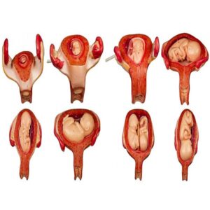 The uterus of the horn