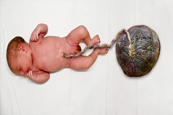 ?What is a fetal placenta