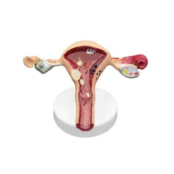 Uterine and ovarian modeling